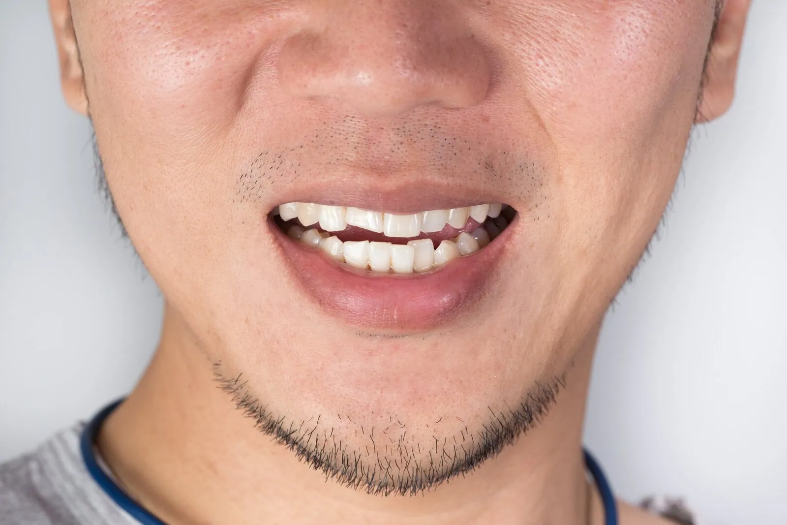 Patient experiencing dental pain in need of urgent care